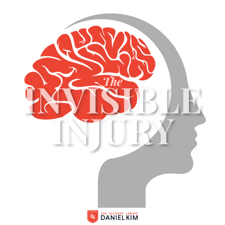 The Invisible Injury: Shedding Light on Traumatic Brain Injuries